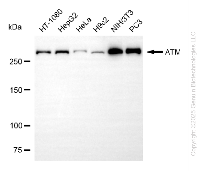 KO Validated Anti-ATM Rabbit Monoclonal Antibody ABG2406