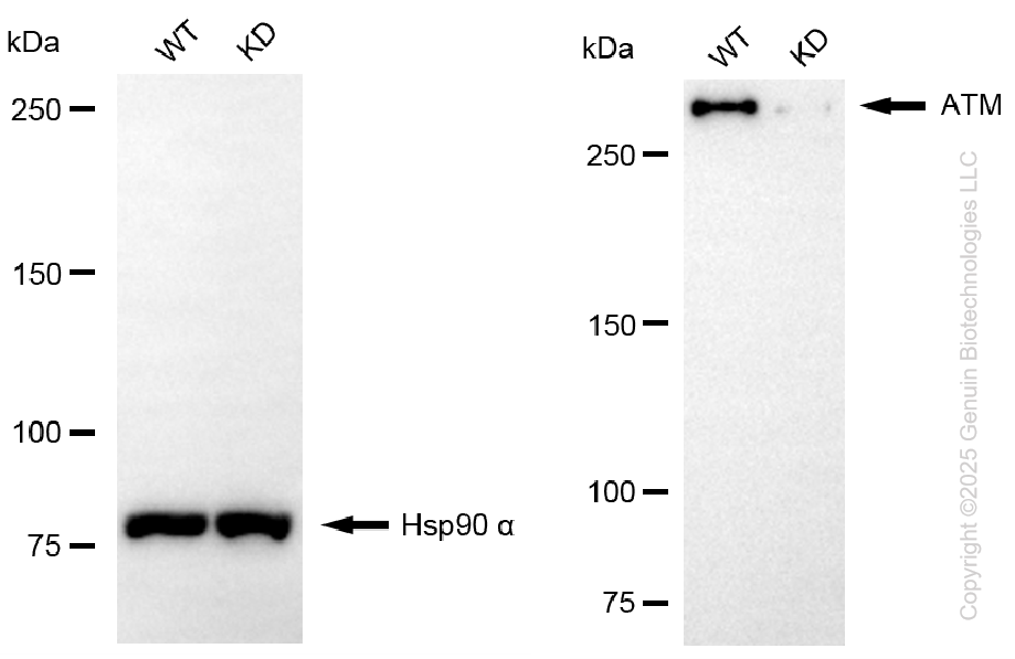 KO Validated Anti-ATM Rabbit Monoclonal Antibody ABG2406