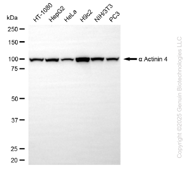 KO Validated Anti-Actinin Alpha 4 Rabbit Monoclonal Antibody ABG2407
