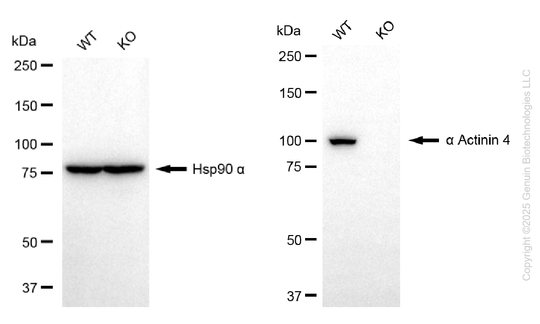 KO Validated Anti-Actinin Alpha 4 Rabbit Monoclonal Antibody ABG2407