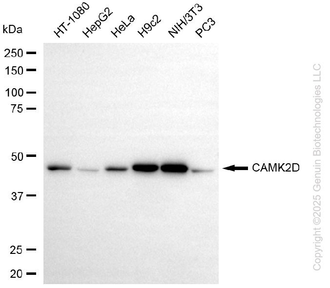 KO Validated Anti-CAMK2D Rabbit Monoclonal Antibody ABG2408