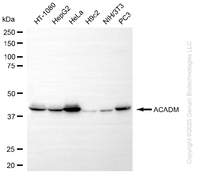KO Validated Anti-ACADM Rabbit Monoclonal Antibody ABG2412