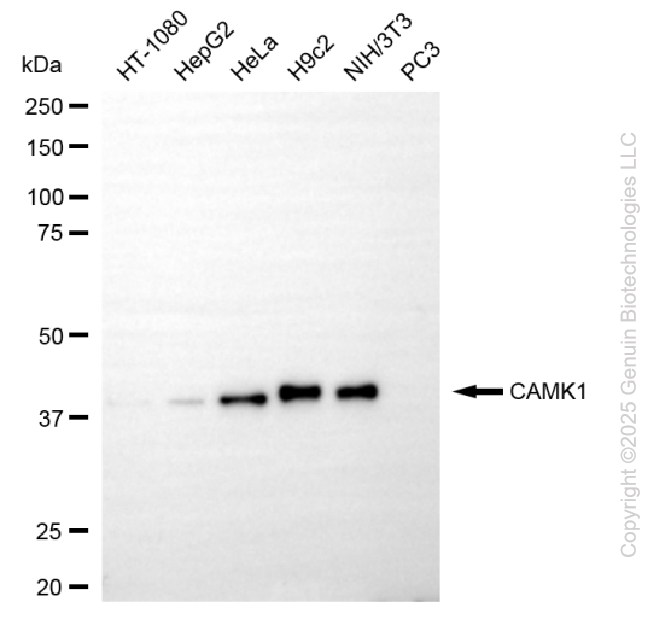 KO Validated Anti-CAMK1 Rabbit Monoclonal Antibody ABG2414