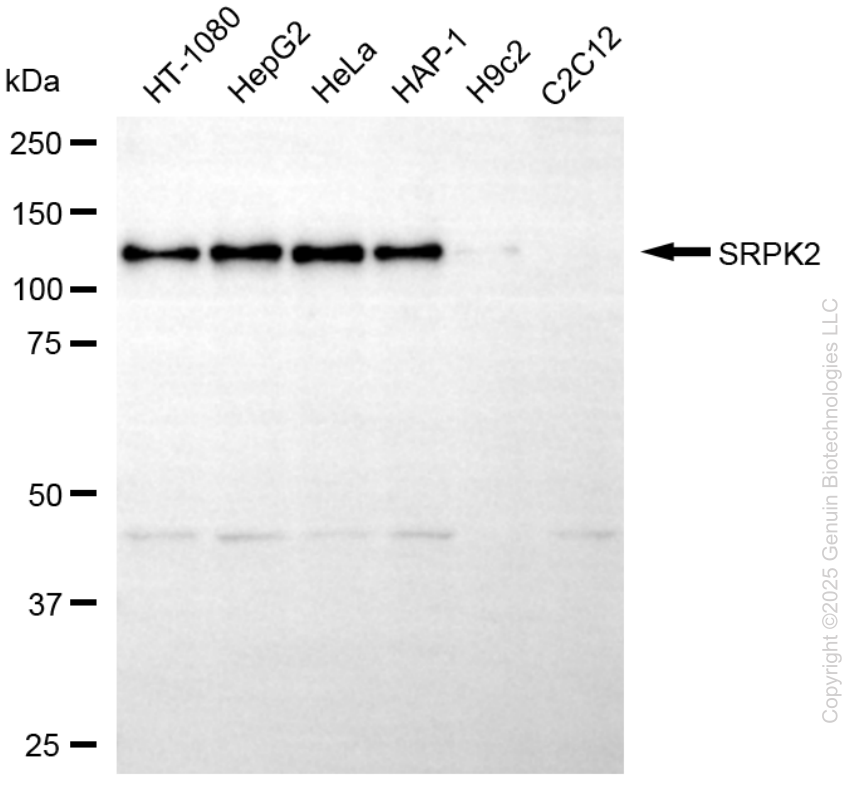 KO-Validated Anti-SRPK2 Mouse Monoclonal Antibody ABG2420
