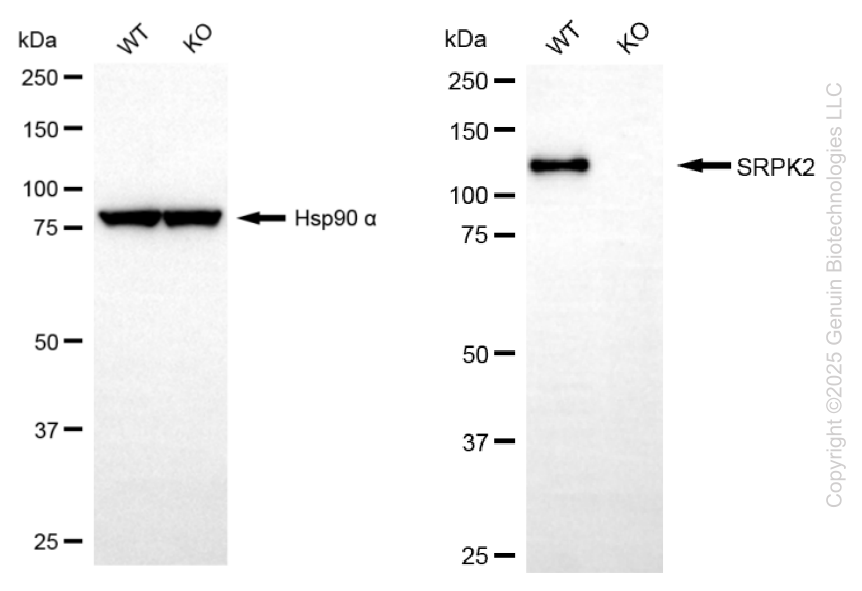 KO-Validated Anti-SRPK2 Mouse Monoclonal Antibody ABG2420