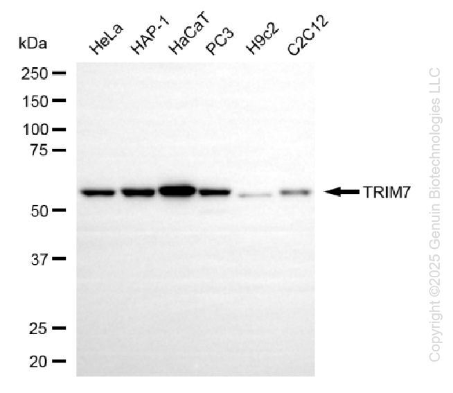 KO-Validated Anti-TRIM7 Mouse Monoclonal Antibody ABG2421