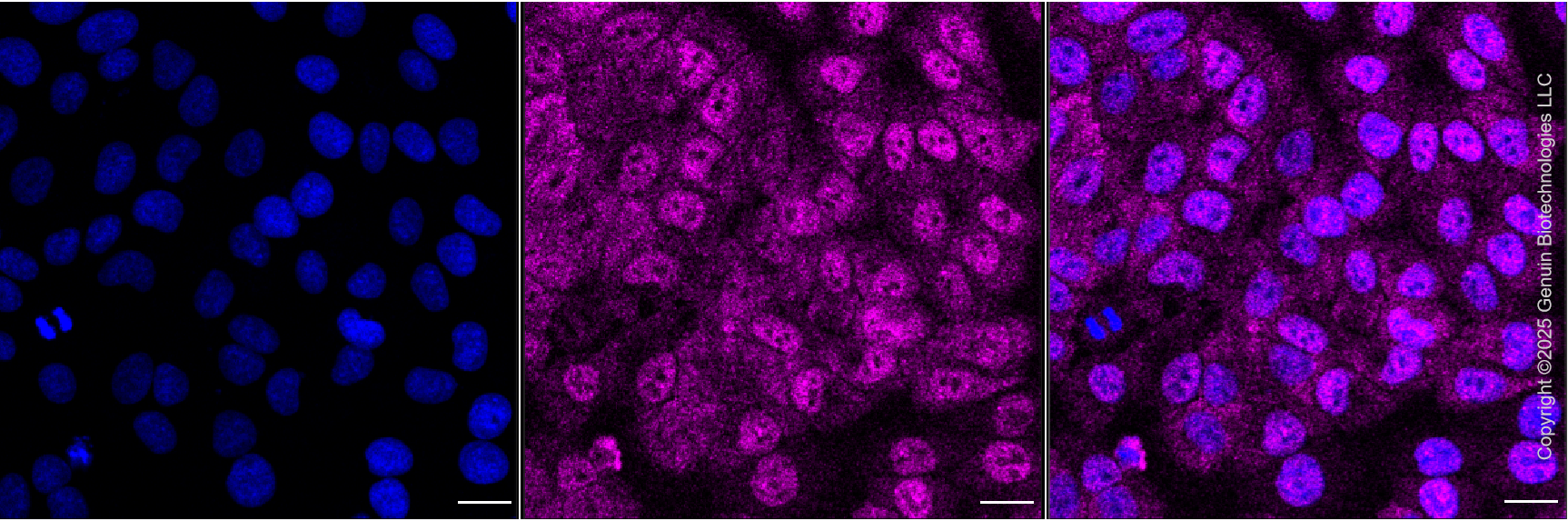 KO-Validated Anti-SMN1 Rabbit Monoclonal Antibody ABG2423