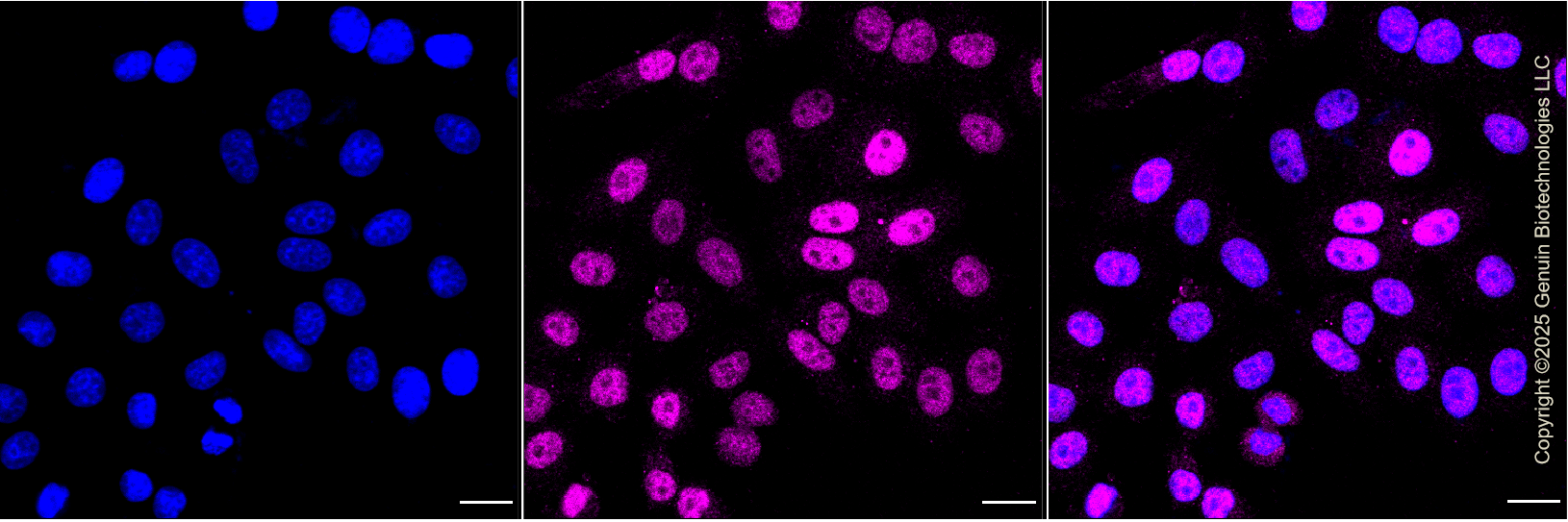 KO-Validated Anti-ETS Transcription Factor ELK1 Rabbit Monoclonal Antibody ABG2428