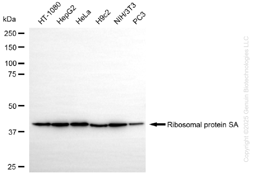KO-Validated Anti-Ribosomal Protein SA Rabbit Monoclonal Antibody ABG2429