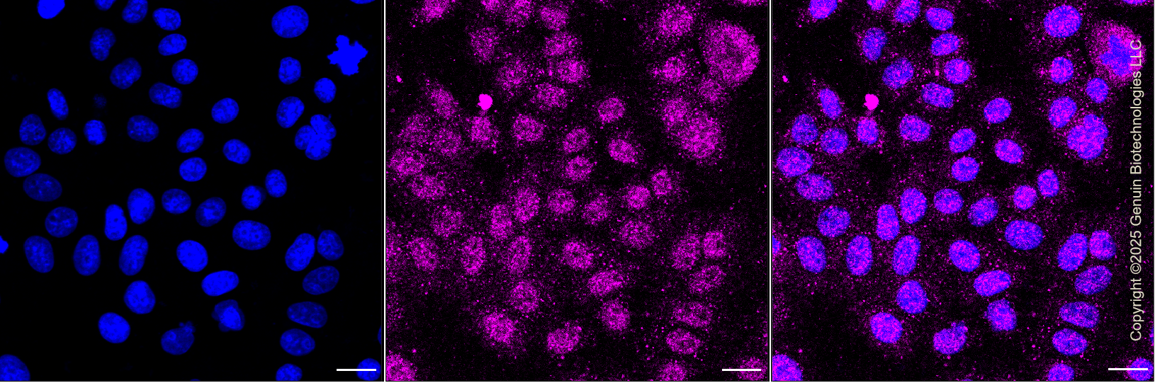 KO-Validated Anti-GSTO1 Rabbit Monoclonal Antibody ABG2431