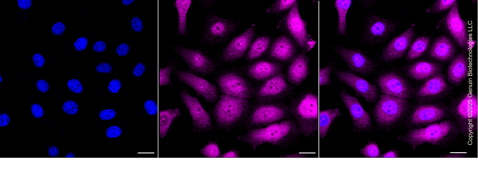 KO-Validated Anti-YAP1 Rabbit Monoclonal Antibody ABG2434