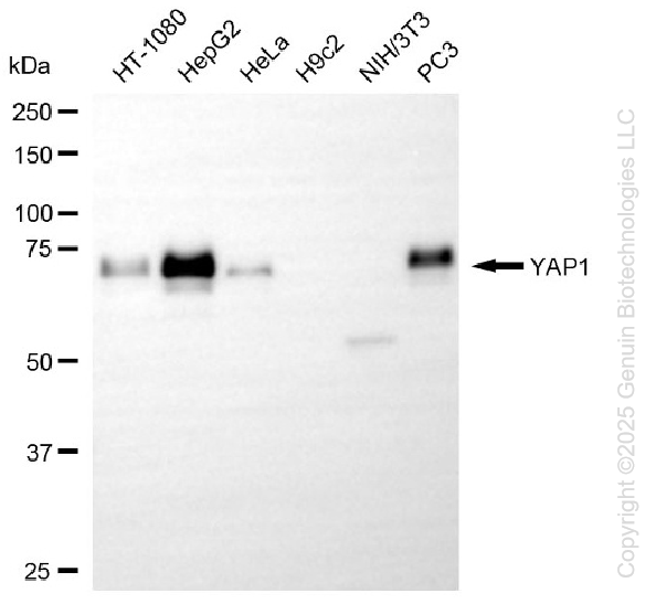 KO-Validated Anti-YAP1 Rabbit Monoclonal Antibody ABG2434