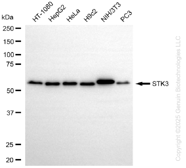 KO-Validated Anti-Serine/Threonine Kinase 3 Rabbit Monoclonal Antibody ABG2435
