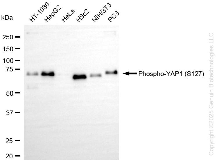 KO-Validated Anti-Phospho-YAP1 (S127) Rabbit Monoclonal Antibody ABG2436