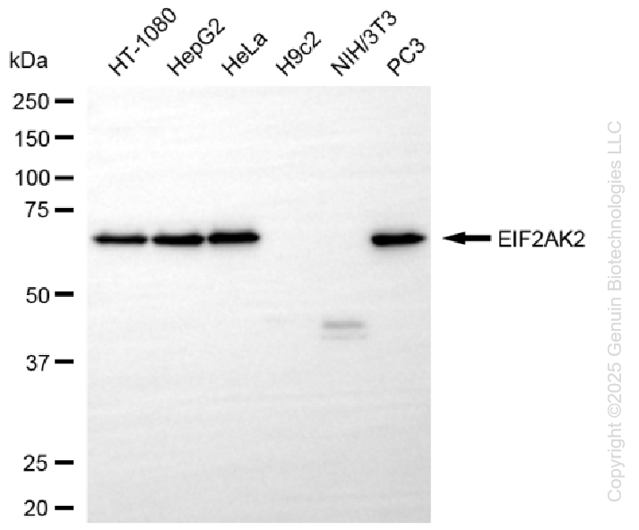 KO-Validated Anti-EIF2AK2 Rabbit Monoclonal Antibody ABG2437