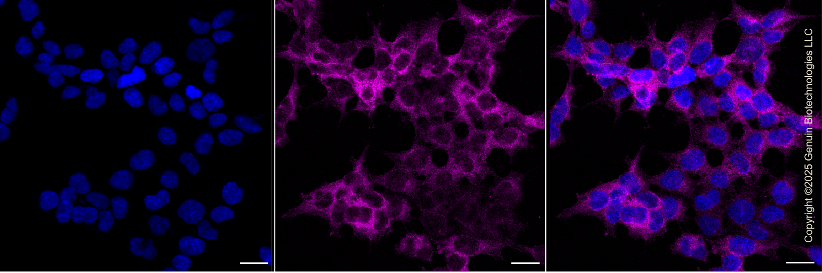KO-Validated Anti-ROCK1 Rabbit Monoclonal Antibody ABG2438