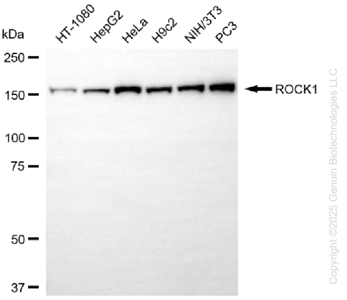 KO-Validated Anti-ROCK1 Rabbit Monoclonal Antibody ABG2438