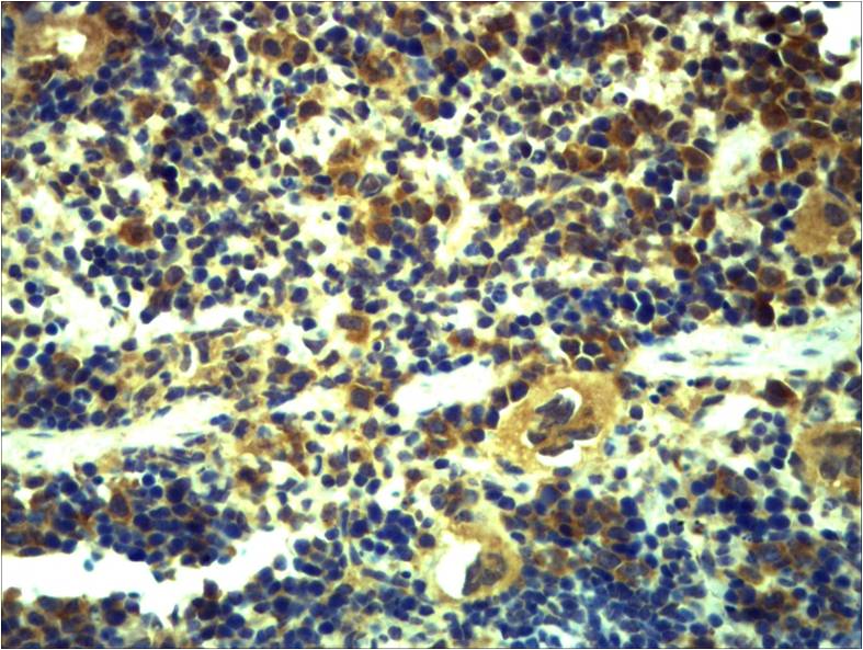 Toll-Like Receptor 6 Rabbit pAb ABZ1277