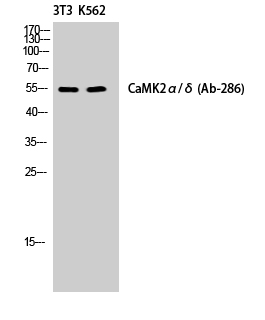 CaMKII alpha/delta Rabbit pAb ABZ1278