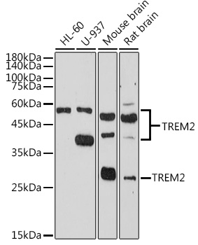 TREM2 Rabbit pAb ABZ1287