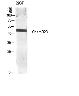 CMKLR1 Rabbit pAb ABZ1307