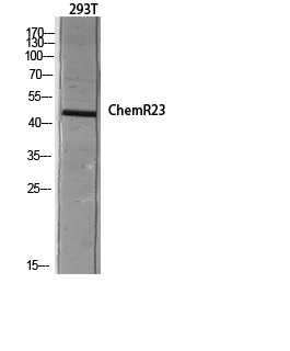CMKLR1 Rabbit pAb ABZ1307