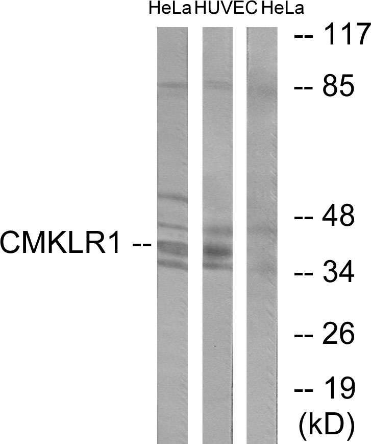 CMKLR1 Rabbit pAb ABZ1307