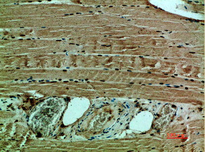 Collagen XII alpha 1 Rabbit pAb ABZ1308