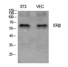 ER beta Rabbit pAb ABZ1316