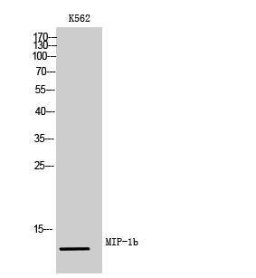 CCL4/MIP-1 beta Rabbit pAb ABZ1317