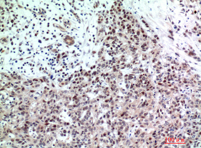 TP53INP2 Rabbit pAb ABZ1321