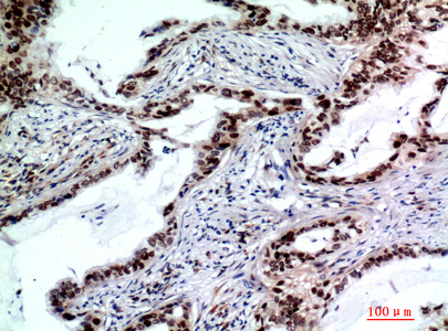 TP53INP2 Rabbit pAb ABZ1321