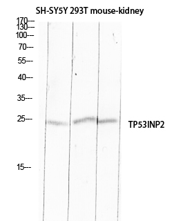 TP53INP2 Rabbit pAb ABZ1321