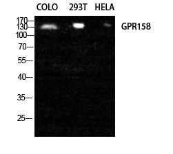 GPR158 Rabbit pAb ABZ1334