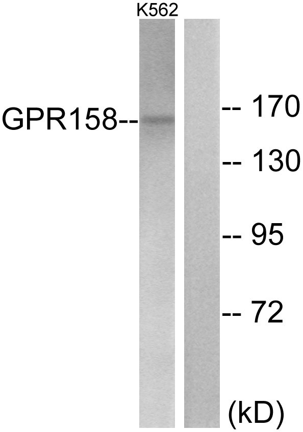 GPR158 Rabbit pAb ABZ1334