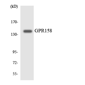 GPR158 Rabbit pAb ABZ1334