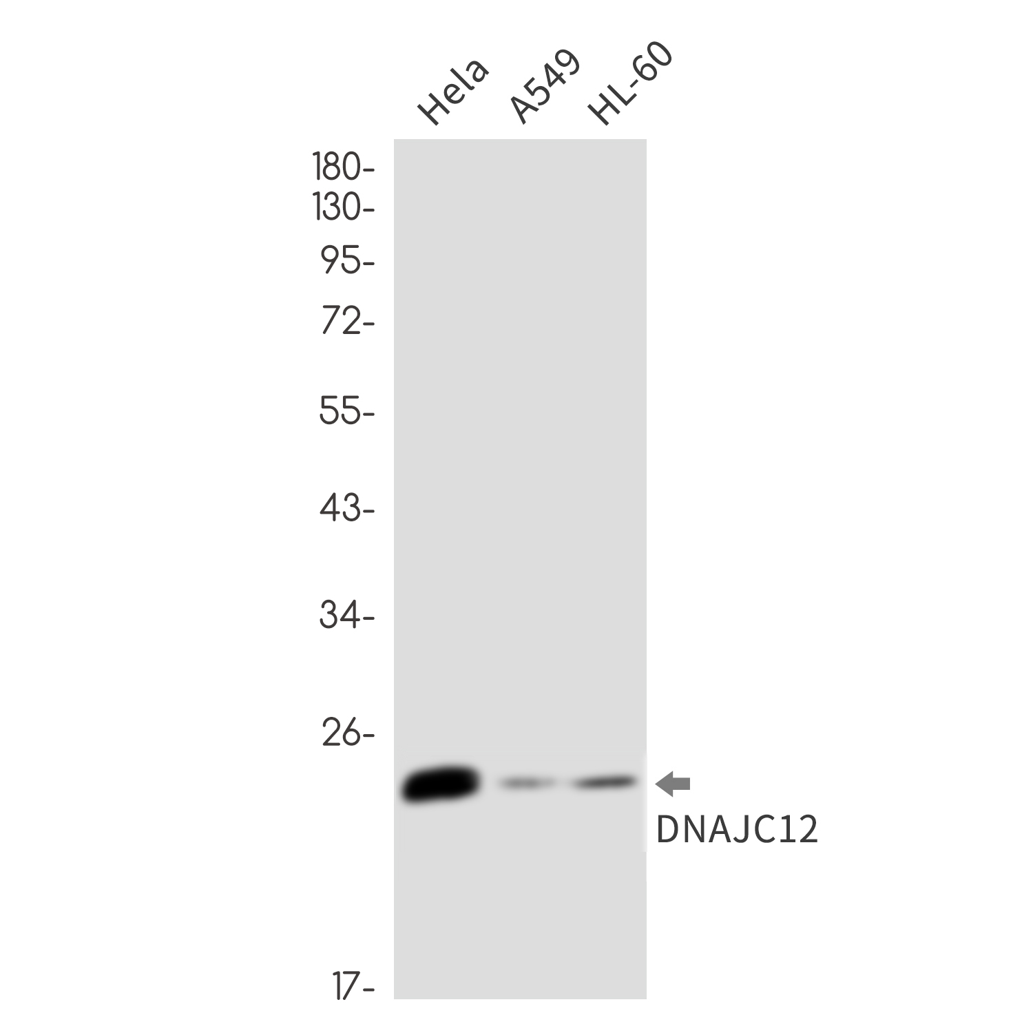 DNAJC12 Rabbit mAb ABZ1339