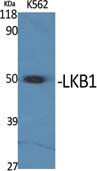 LKB1 Rabbit pAb ABZ1341