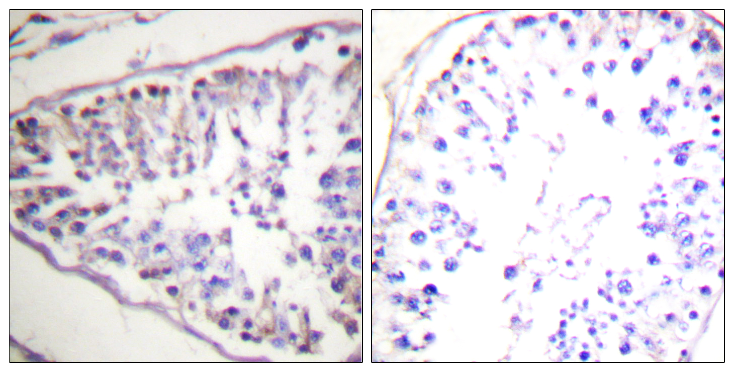 Hormone Sensitive Lipase/HSL Rabbit pAb ABZ1360