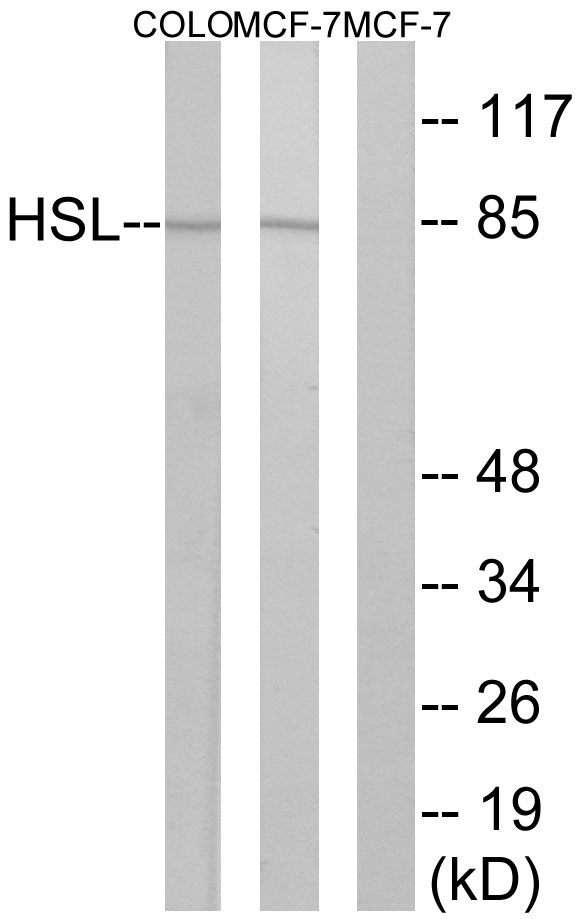 Hormone Sensitive Lipase/HSL Rabbit pAb ABZ1360