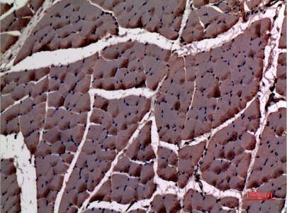 alpha Smooth Muscle Actin Rabbit pAb ABZ1369