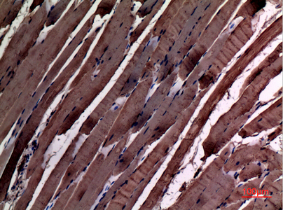 alpha Smooth Muscle Actin Rabbit pAb ABZ1369