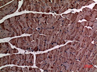 alpha Smooth Muscle Actin Rabbit pAb ABZ1369