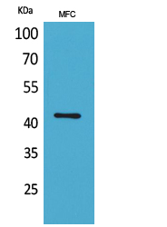 alpha Smooth Muscle Actin Rabbit pAb ABZ1369