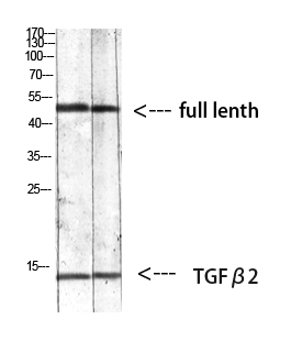 TGF beta 2 Rabbit pAb ABZ1372