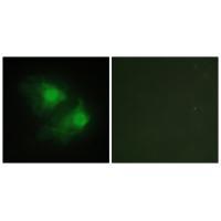 LIM Kinase 2 Rabbit pAb ABZ1378