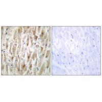 LIM Kinase 2 Rabbit pAb ABZ1378
