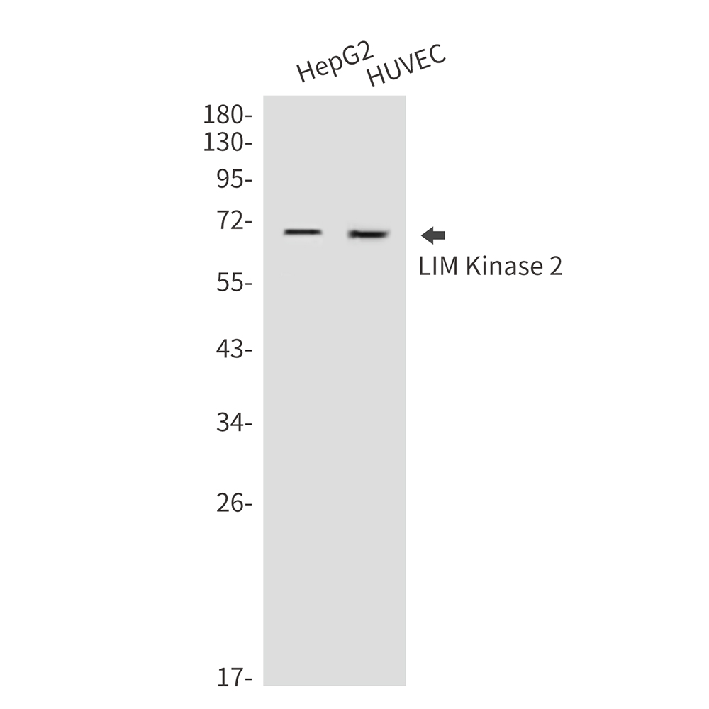 LIM Kinase 2 Rabbit pAb ABZ1378