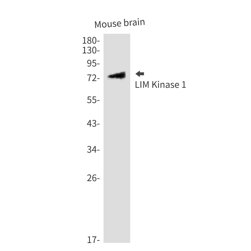 LIM Kinase 1 Rabbit pAb ABZ1379