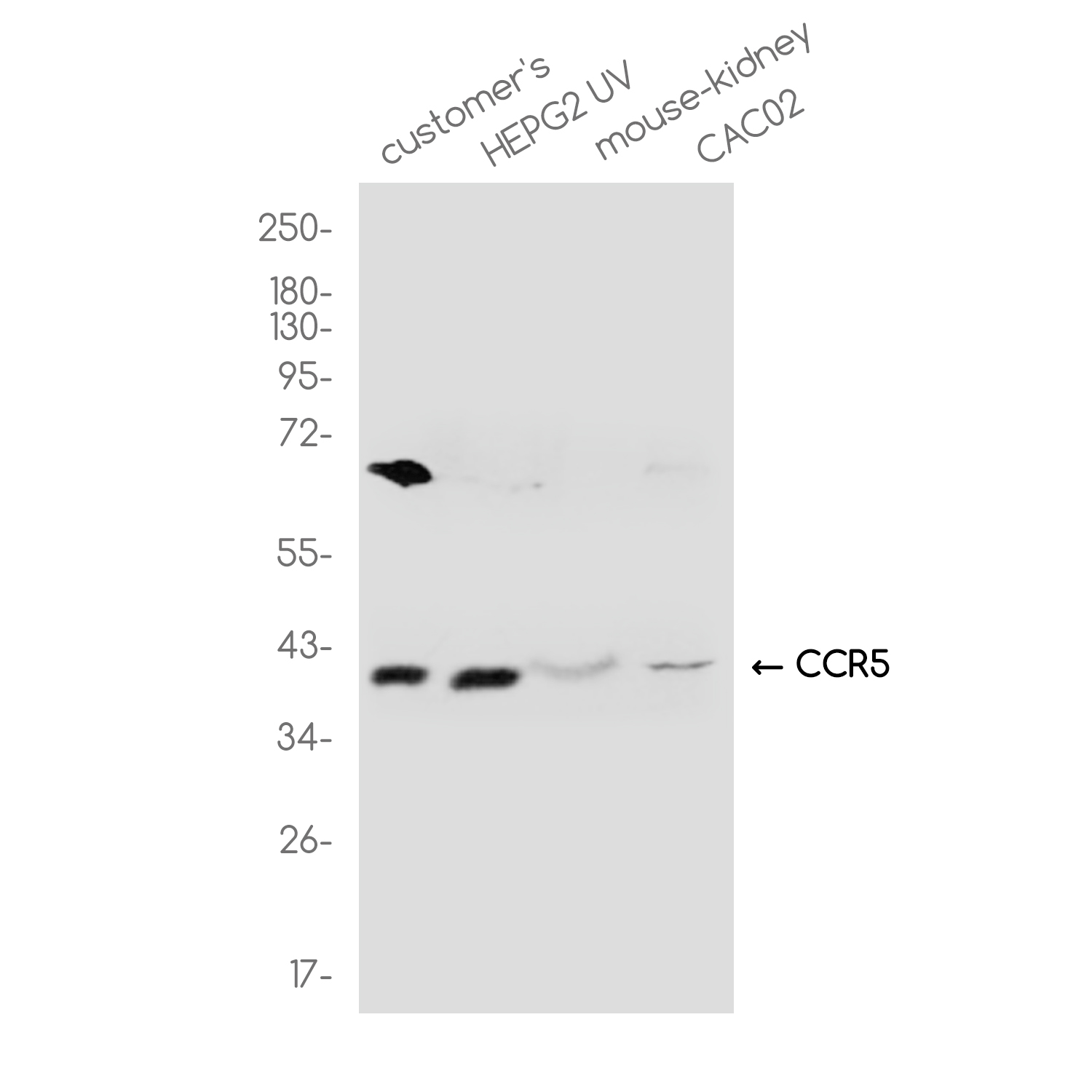 CCR5 Rabbit pAb ABZ1381